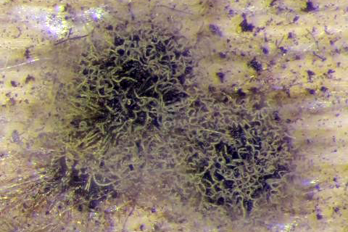 Рис. 4. Гриб-антагоніст Chaetomium cochliodes Рис. 4. Гриб-антагоніст Chaetomium cochliodes