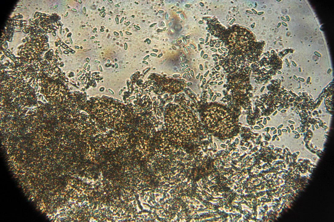 Рис. 6. Гриб Ampelomyces quisqualis Рис. 6. Гриб Ampelomyces quisqualis