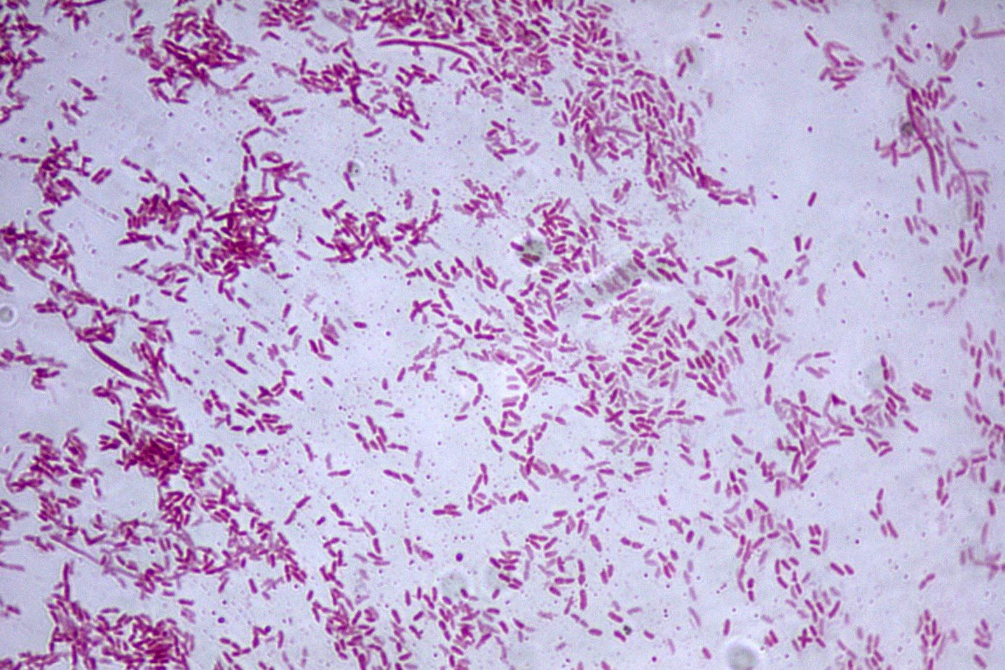 Рис. 1. Бактерія Pseudomonas fluorescens Рис. 1. Бактерія Pseudomonas fluorescens